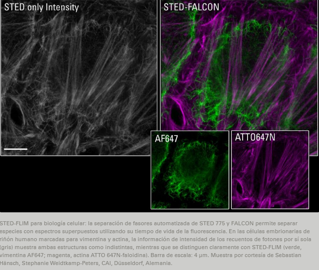 Sistema Confocal Leica Stellaris STED