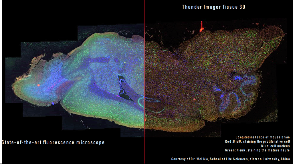 Sistema de imagen Leica Thunder