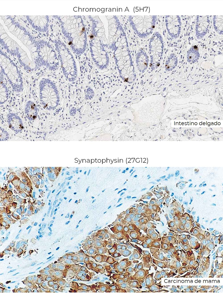 Patología de Cabeza, Cuello y Endocrino